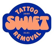Swift Tattoo Removal